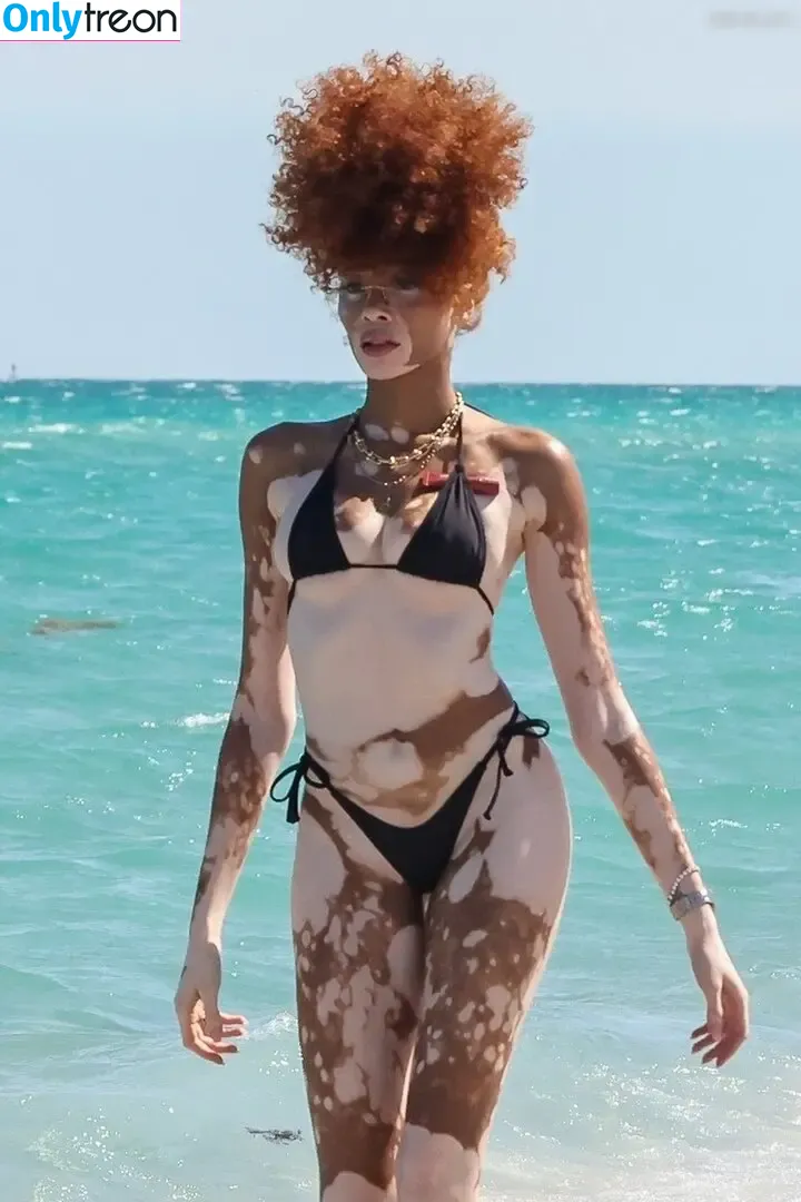 Winnie Harlow nude photo #0491 (winnieharlow)