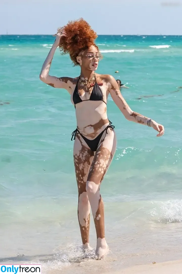 Winnie Harlow nude photo #0494 (winnieharlow)