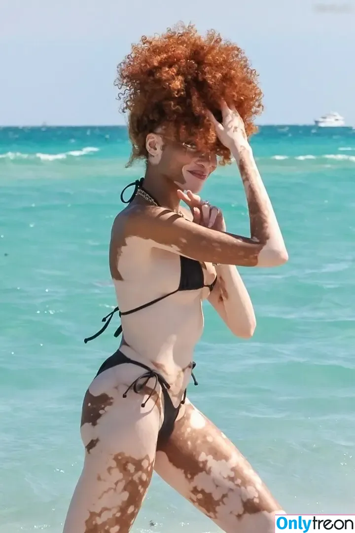 Winnie Harlow nude photo #0495 (winnieharlow)
