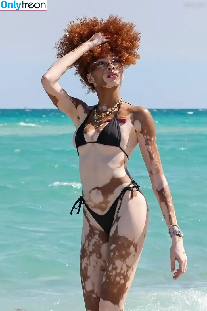 Winnie Harlow nude photo #0496 (winnieharlow)