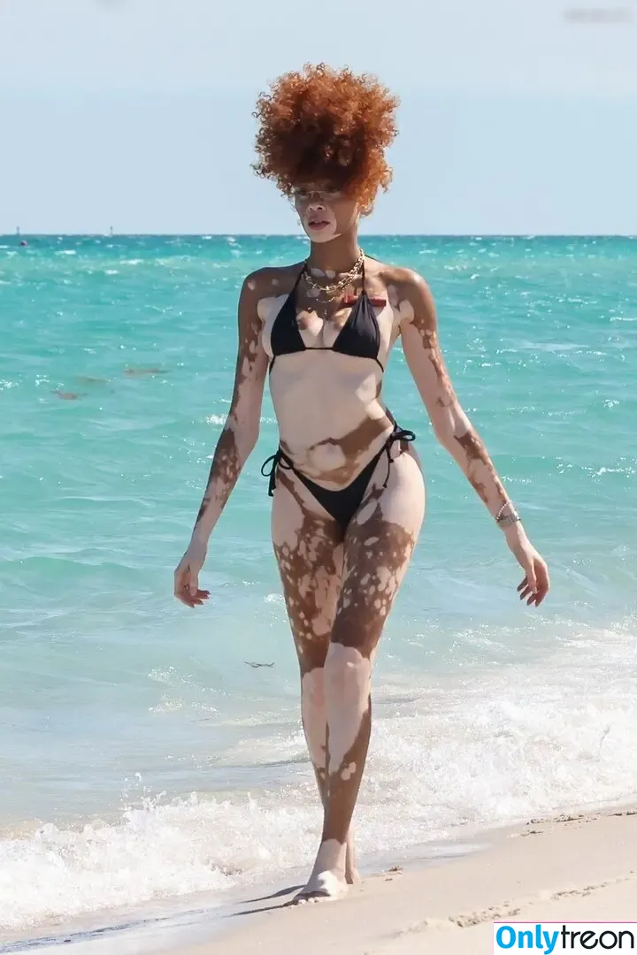 Winnie Harlow nude photo #0497 (winnieharlow)