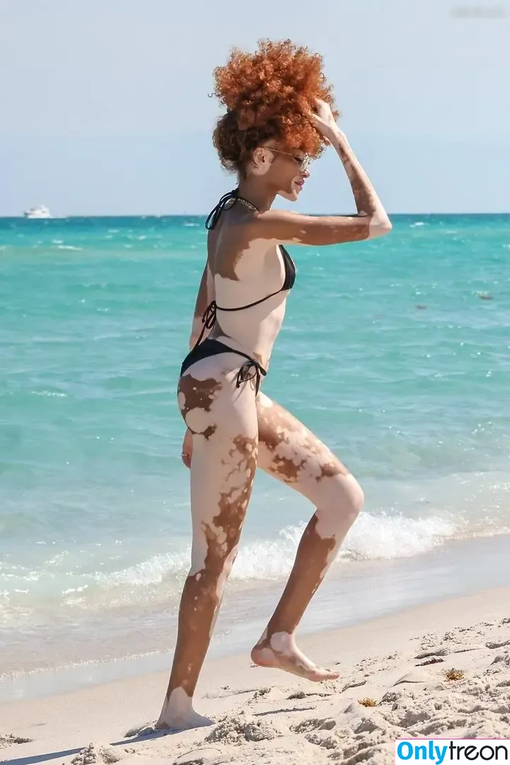 Winnie Harlow nude photo #0500 (winnieharlow)