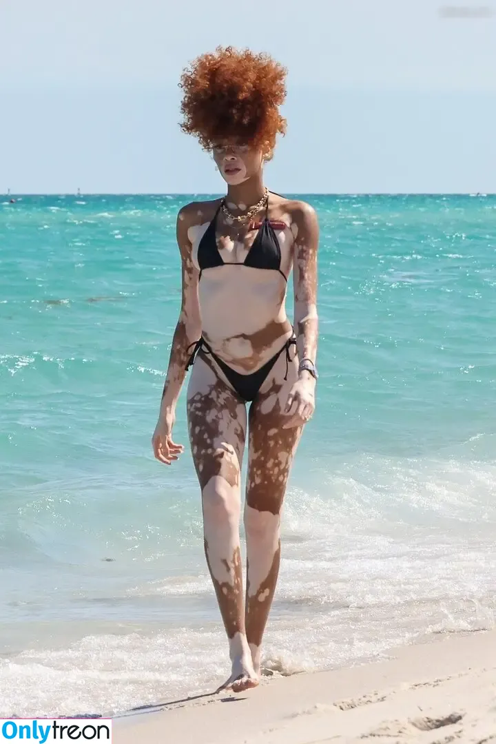 Winnie Harlow nude photo #0501 (winnieharlow)