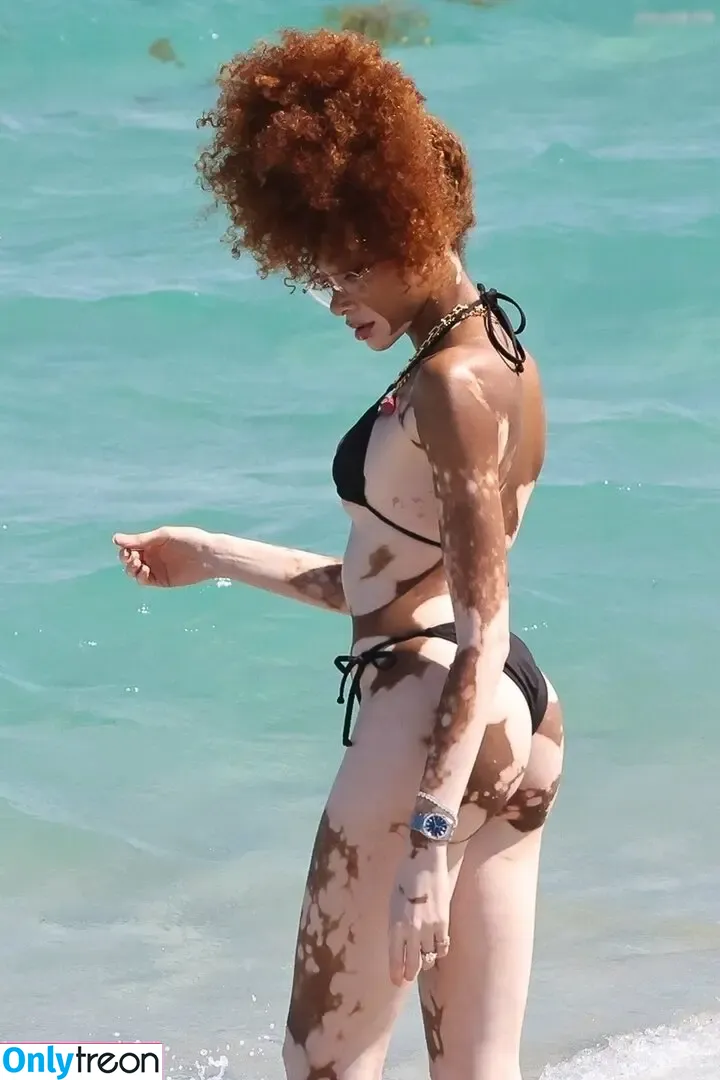 Winnie Harlow nude photo #0502 (winnieharlow)