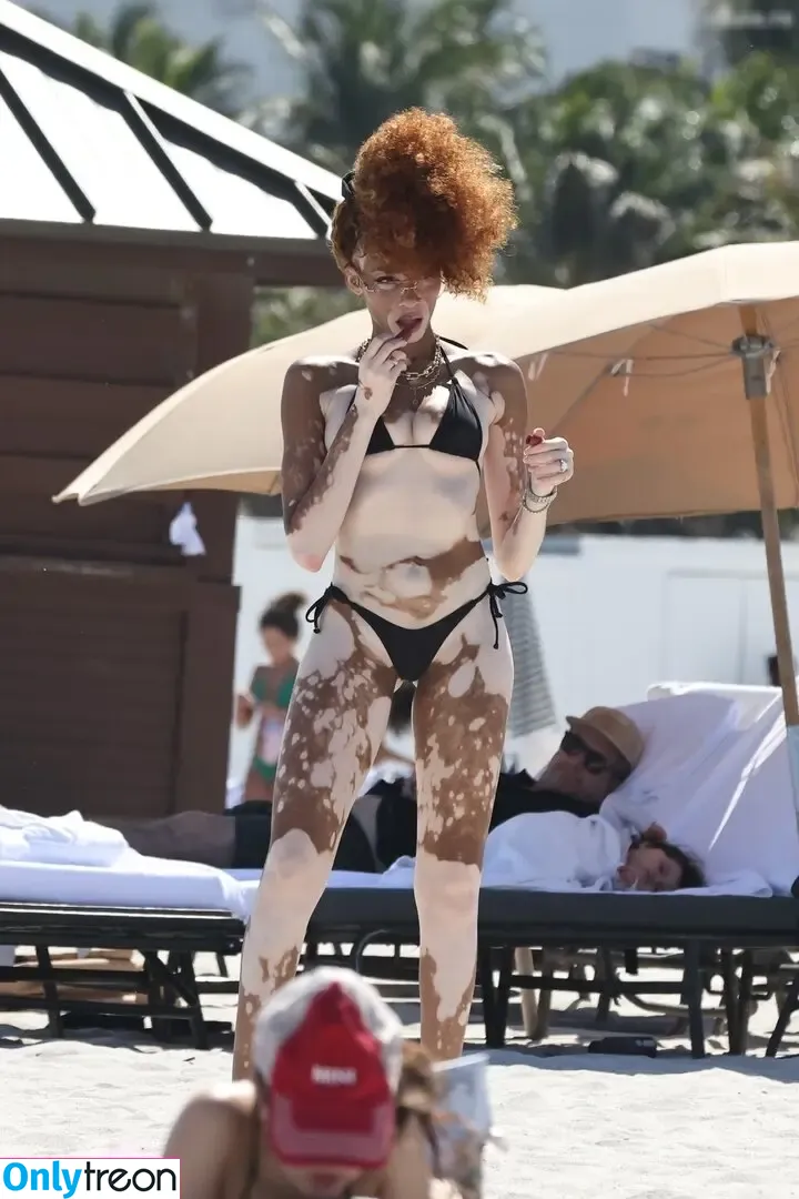 Winnie Harlow nude photo #0505 (winnieharlow)