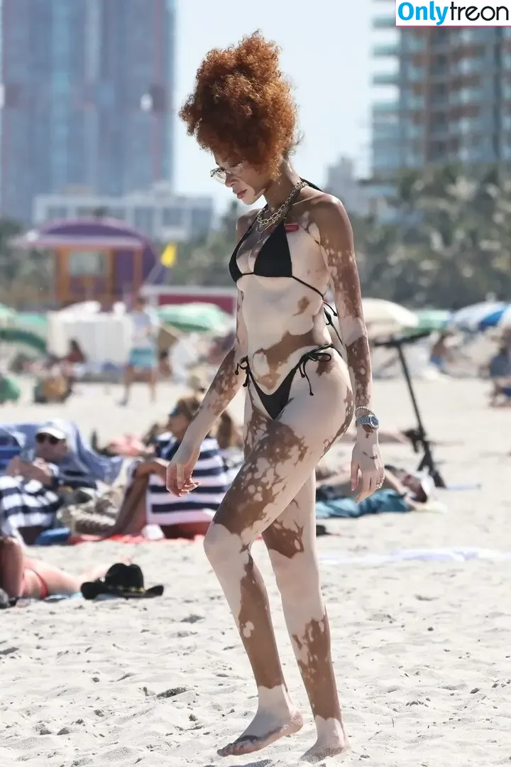 Winnie Harlow nude photo #0510 (winnieharlow)