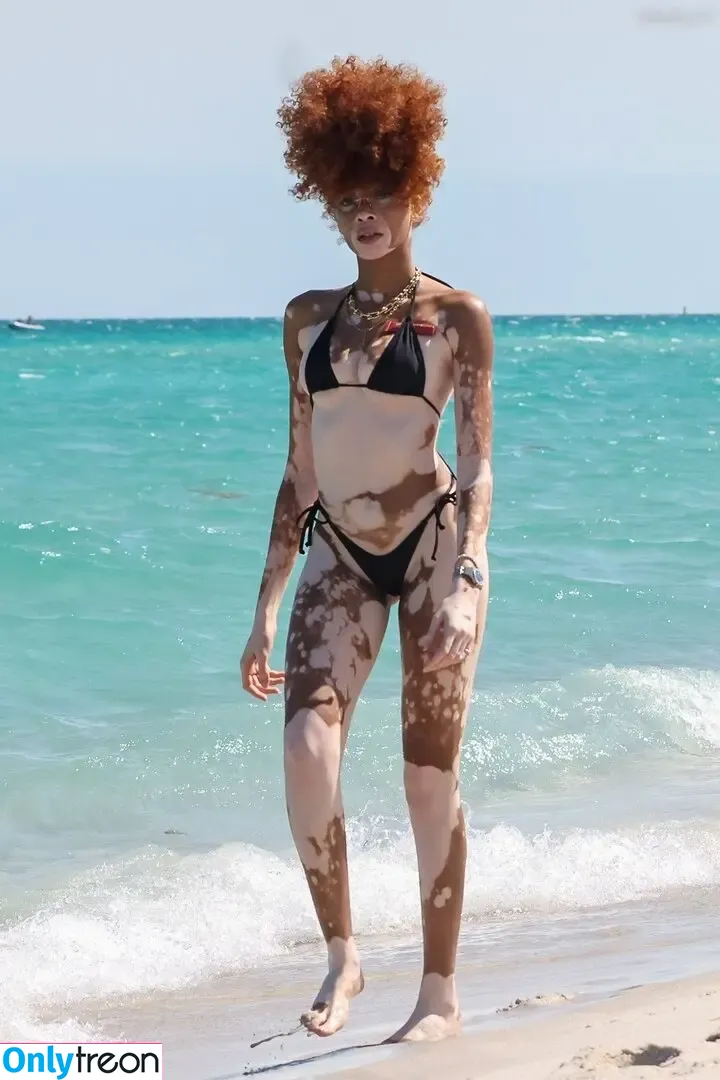 Winnie Harlow nude photo #0513 (winnieharlow)
